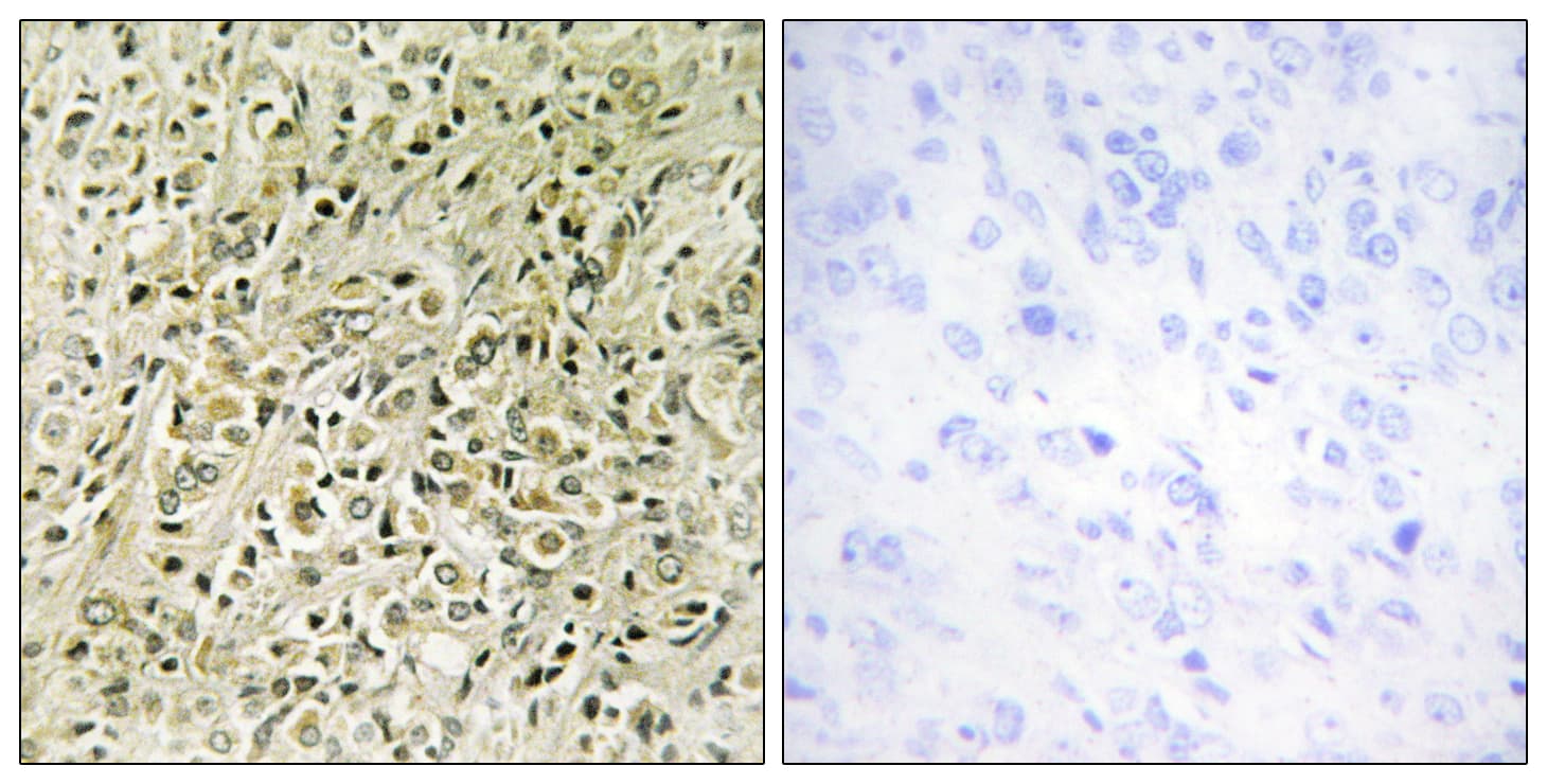 DLC1 Antibody (aa61-110)