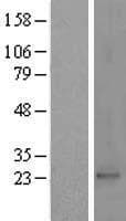 PRKRIP1 Protein (Over-Expression Lysate Myc-DDK (Flag))