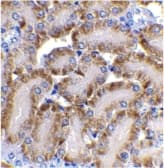 DFFB Antibody