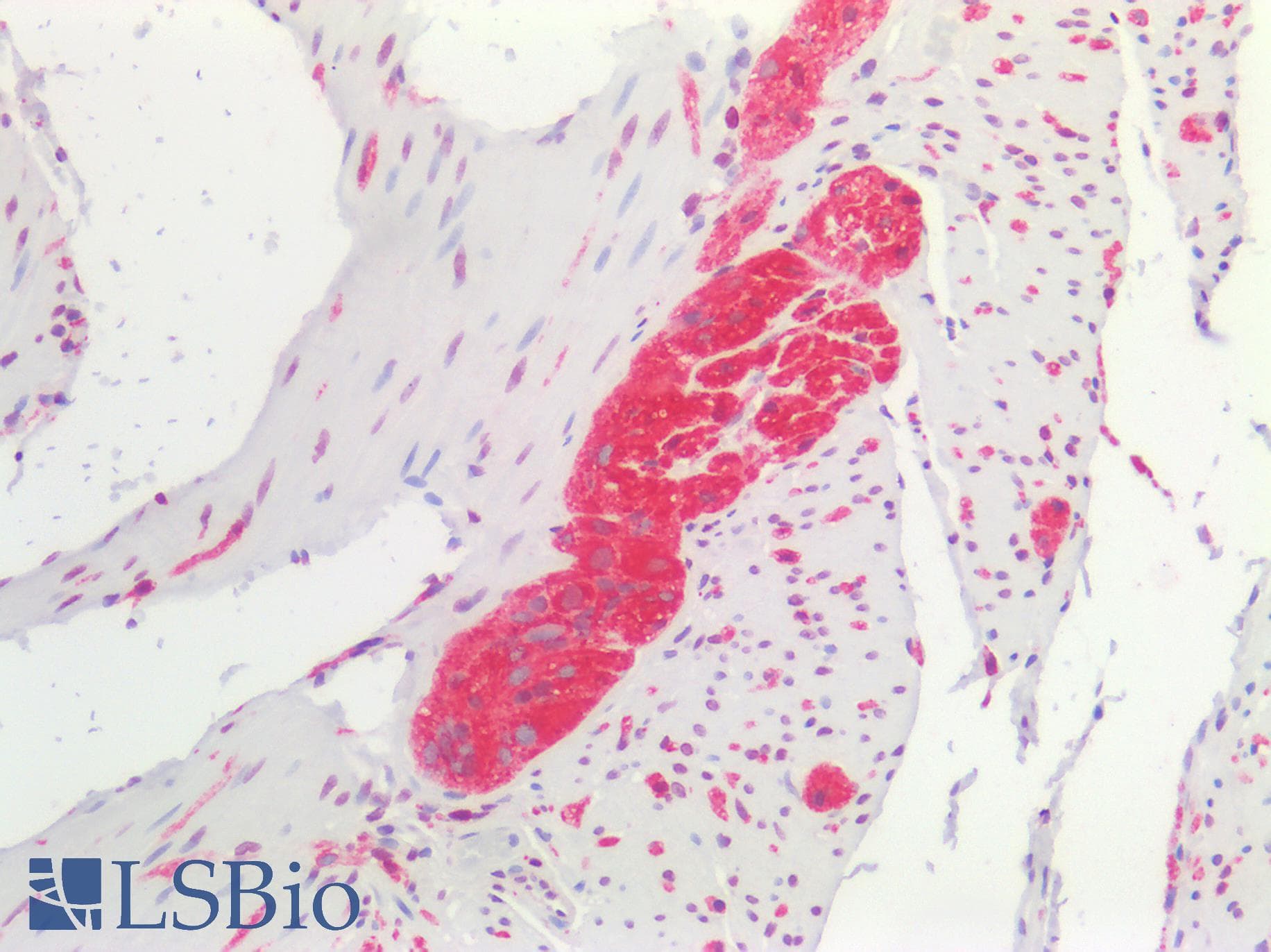 PathPlus™ Polyclonal Rabbit anti-Human MAPT / Tau Antibody (IHC)