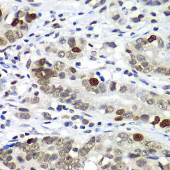 Polyclonal Rabbit anti-Human DR1 / NC2 Antibody (IHC, WB)