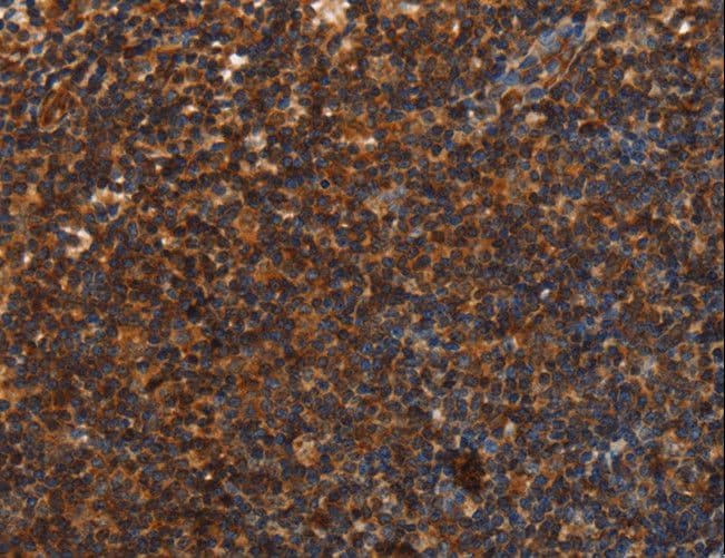 UPK3B Antibody