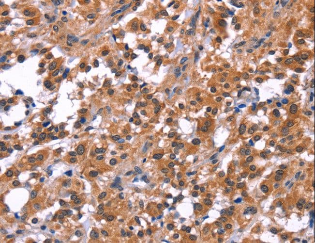 PIP5K1B Antibody