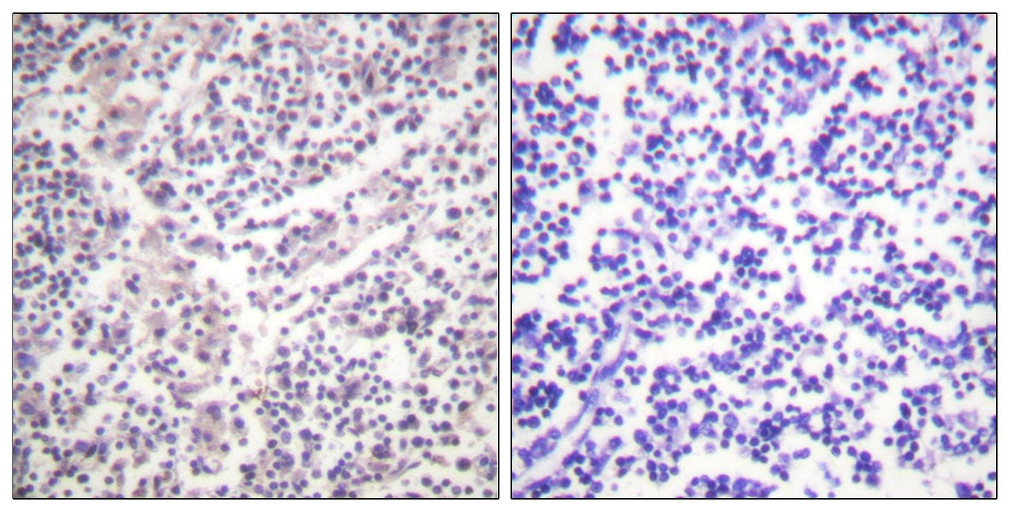 CASP3 / Caspase 3 Antibody (phospho-Ser150)