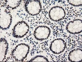 PYCRL Antibody (clone OTI8H6)