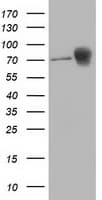 Monoclonal Mouse anti-Human CTNNB1 / Beta Catenin Antibody (clone OTI8B5, IF, WB)