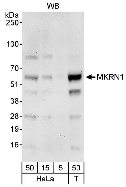 MKRN1 Antibody (aa432-C-term)