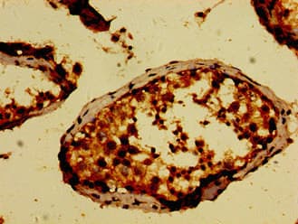 NEK9 Antibody