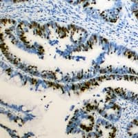 RB1 / Retinoblastoma / RB Antibody (C-Terminus)
