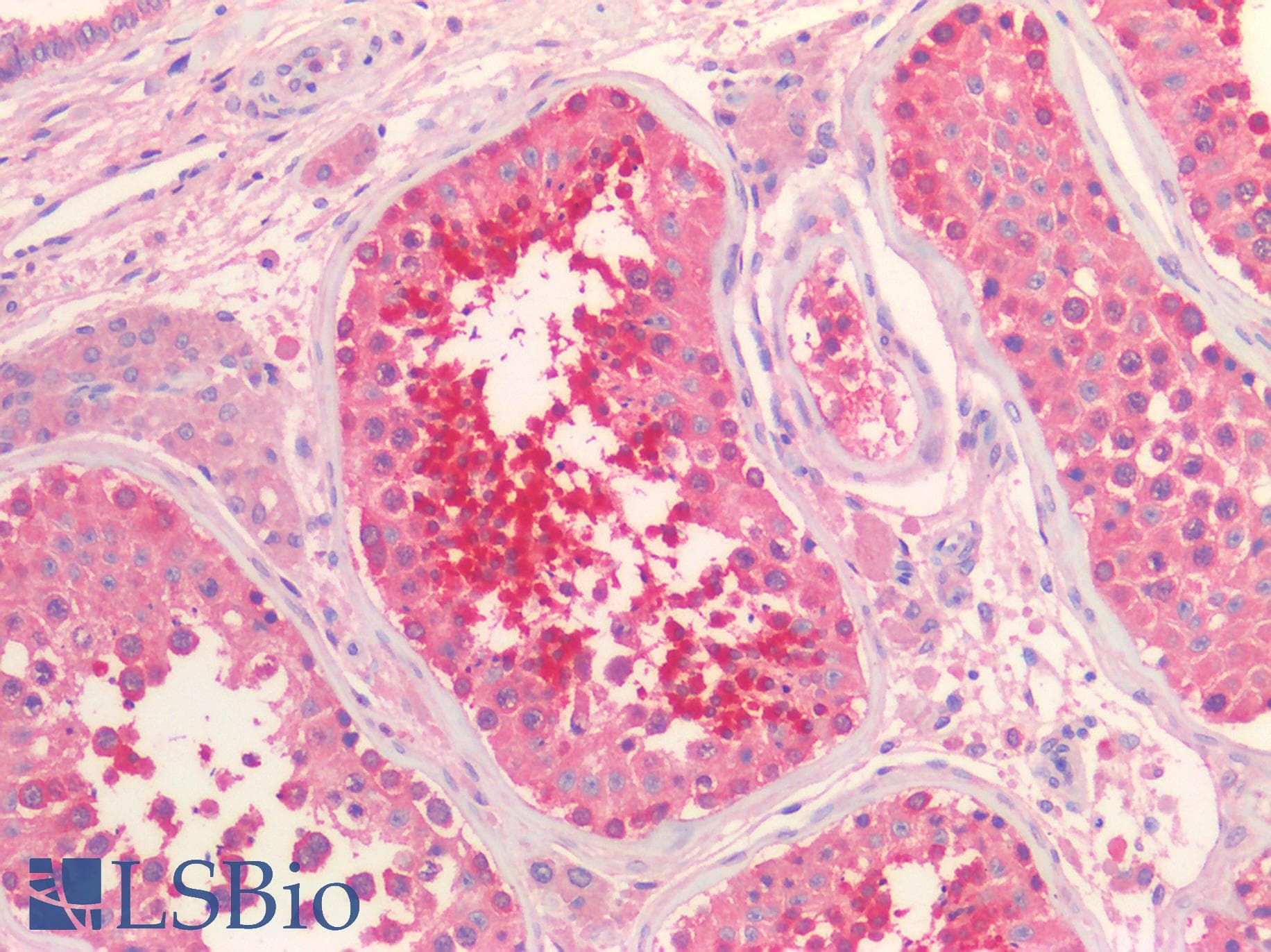 IHC-plus™ ADORA2A/Adenosine A2A Receptor Antibody