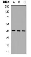 CTSL / Cathepsin L Antibody (Internal)