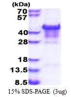 Human CA14 / Carbonic Anhydrase XIV Protein (Recombinant His)