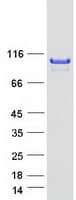 Human ABR Protein (Recombinant Myc-DDK (Flag))