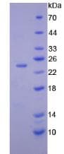 Human IL-10 Protein (Recombinant His-T7)