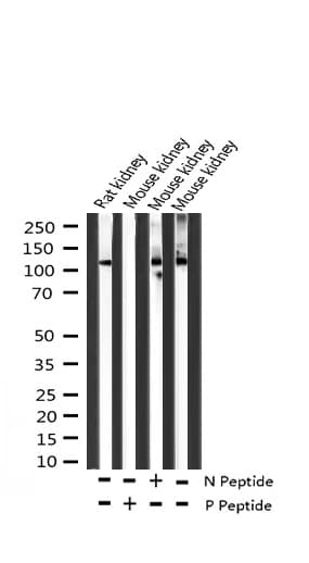 Polyclonal Rabbit anti-Human FAK / Focal Adhesion Kinase Antibody (phospho-Tyr925, IF, WB)