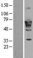 PDE1B Protein (Over-Expression Lysate Myc-DDK (Flag))