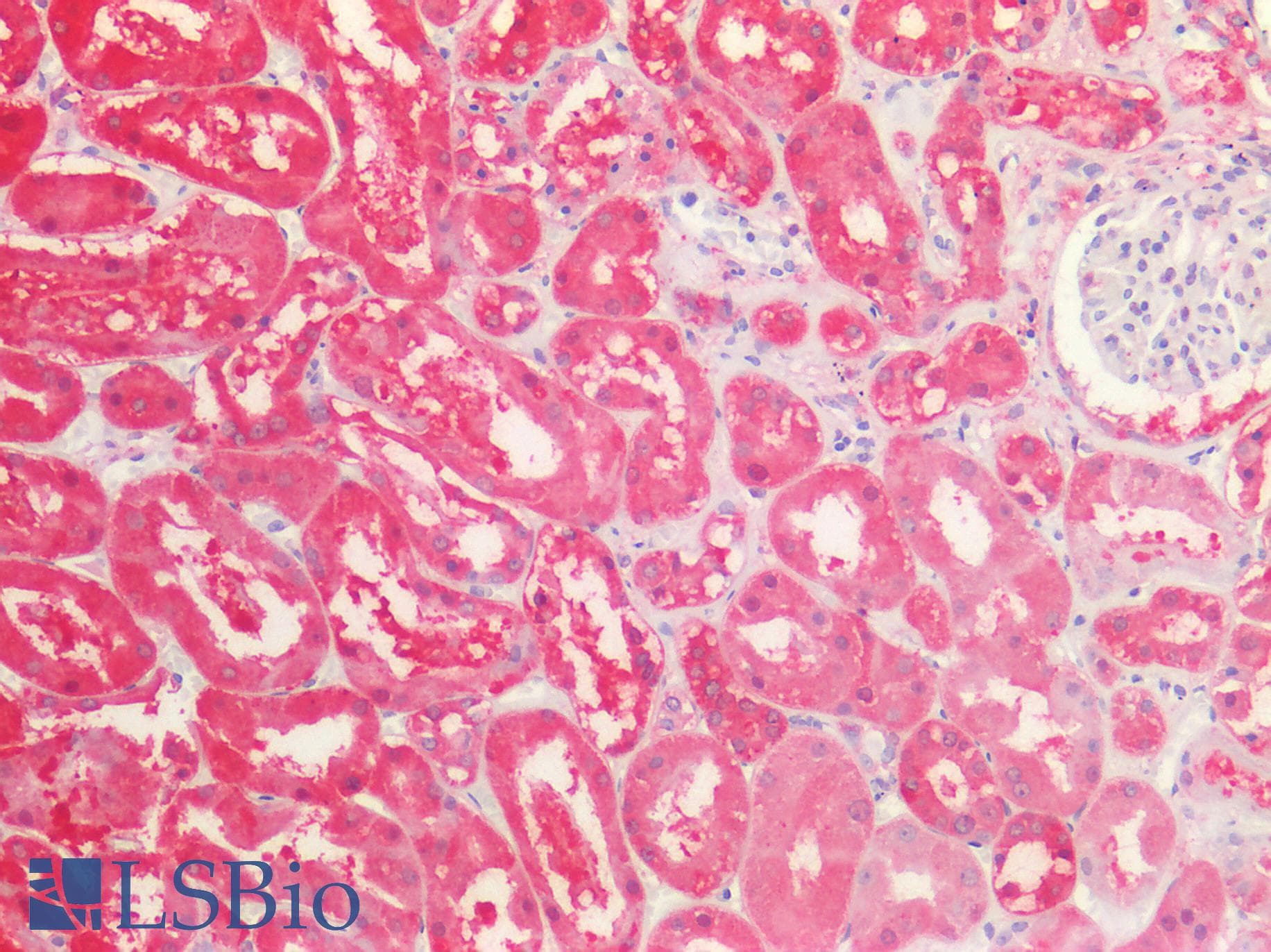 PathPlus™ ALDH1A1 / ALDH1 Antibody