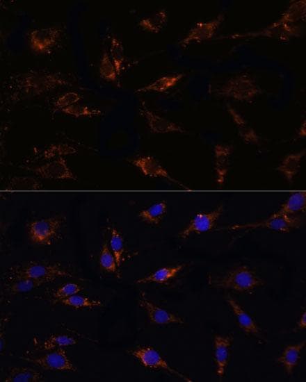 TGFB1 / TGF Beta 1 Antibody