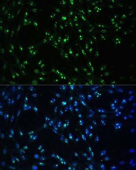 CCDC59 Antibody