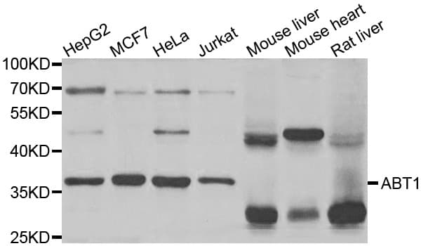 HABT1 / ABT1 Antibody