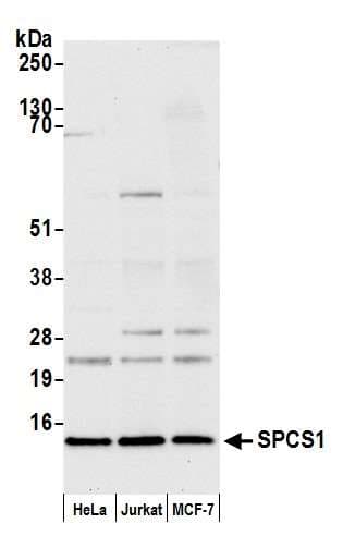 SPCS1 Antibody (aa52-102)
