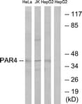 F2RL3 / PAR4 Antibody (aa29-78)