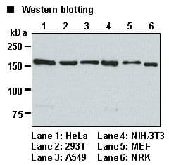 IHC-plus™ Polyclonal Rabbit anti-Human EEA1 Antibody (IHC, WB)