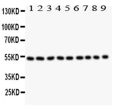 Polyclonal Rabbit anti-Human DES / Desmin Antibody (aa1-304, IHC, WB)