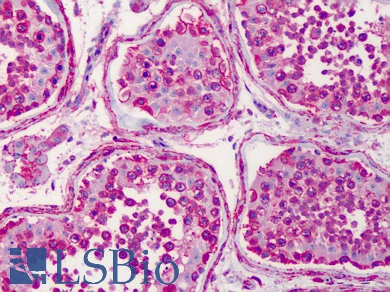 IHC-plus™ HSP90AA1 / Hsp90 Alpha A1 Antibody