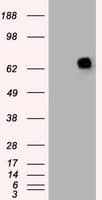 PMEL / SILV / gp100 Antibody (clone OTI8A4)
