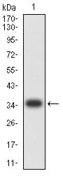Monoclonal Mouse anti-Human CIRP / CIRBP Antibody (clone 6E12D5, IHC, WB)