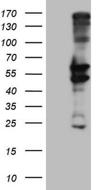 Monoclonal Mouse anti-Human Peripherin Antibody (clone OTI4A2, WB)