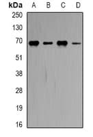 Polyclonal Rabbit anti-Human CBS Antibody (IHC, IF, WB)