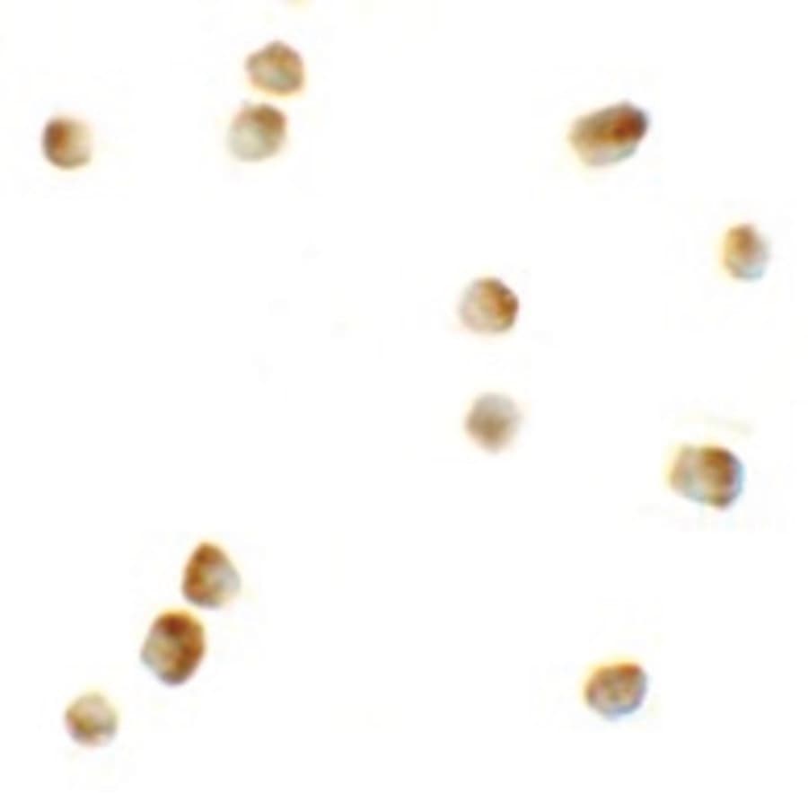 IHC-plus™ Rho Kinase / ROCK1 Antibody