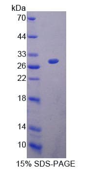 Mouse CHRNA2 Protein (Recombinant His-T7)