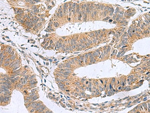 MARCKSL1 Antibody