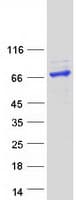 Human ADAD1 Protein (Recombinant Myc-DDK (Flag))