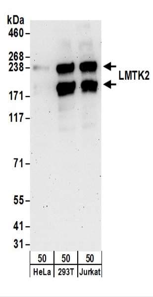 KPI-2 / LMTK2 Antibody (aa675-725)