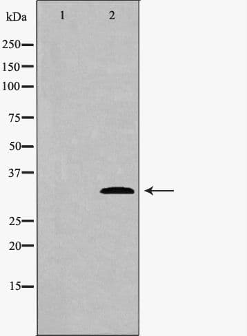 Polyclonal Rabbit anti-Human CDK4 Antibody (IHC, WB)