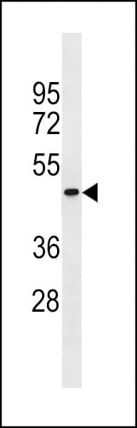 Polyclonal Rabbit anti-Human PGLYRP4 Antibody (aa242-268, WB)