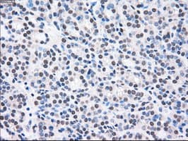 MAP2K2 / MKK2 / MEK2 Antibody (clone OTI8G6)