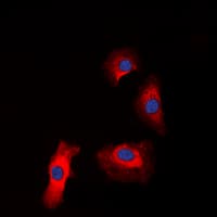 IGF1R / IGF1 Receptor Antibody (phospho-Tyr1161)
