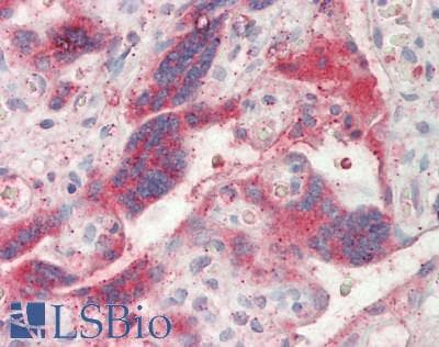 IHC-plus™ RELA / NFKB p65 Antibody (aa435-484)