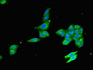 SPG15 / ZFYVE26 Antibody