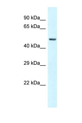 GC / Vitamin D-Binding Protein Antibody (aa70-119)