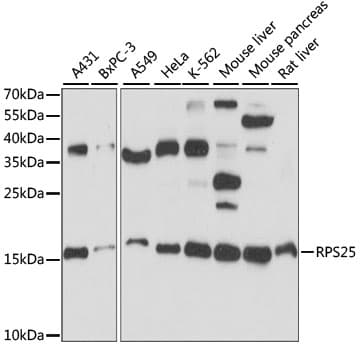 RPS25 / Ribosomal Protein S25 Antibody