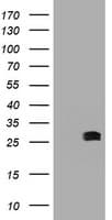 BCL10 / BCL-10 Antibody (clone OTI4H9)