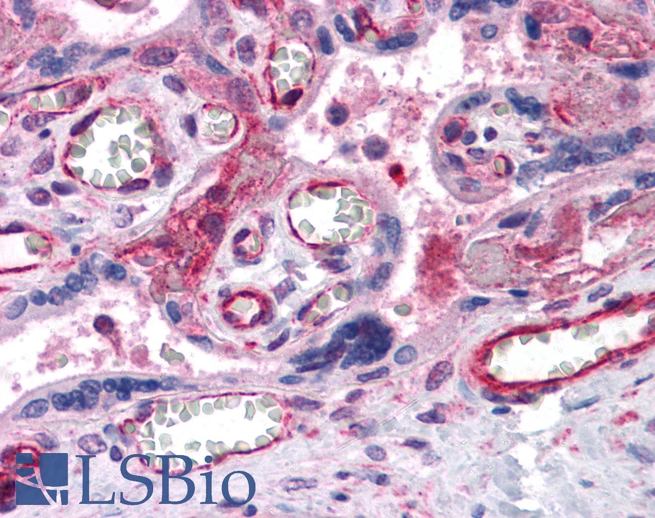 IHC-plus™ PTCHD2 Antibody