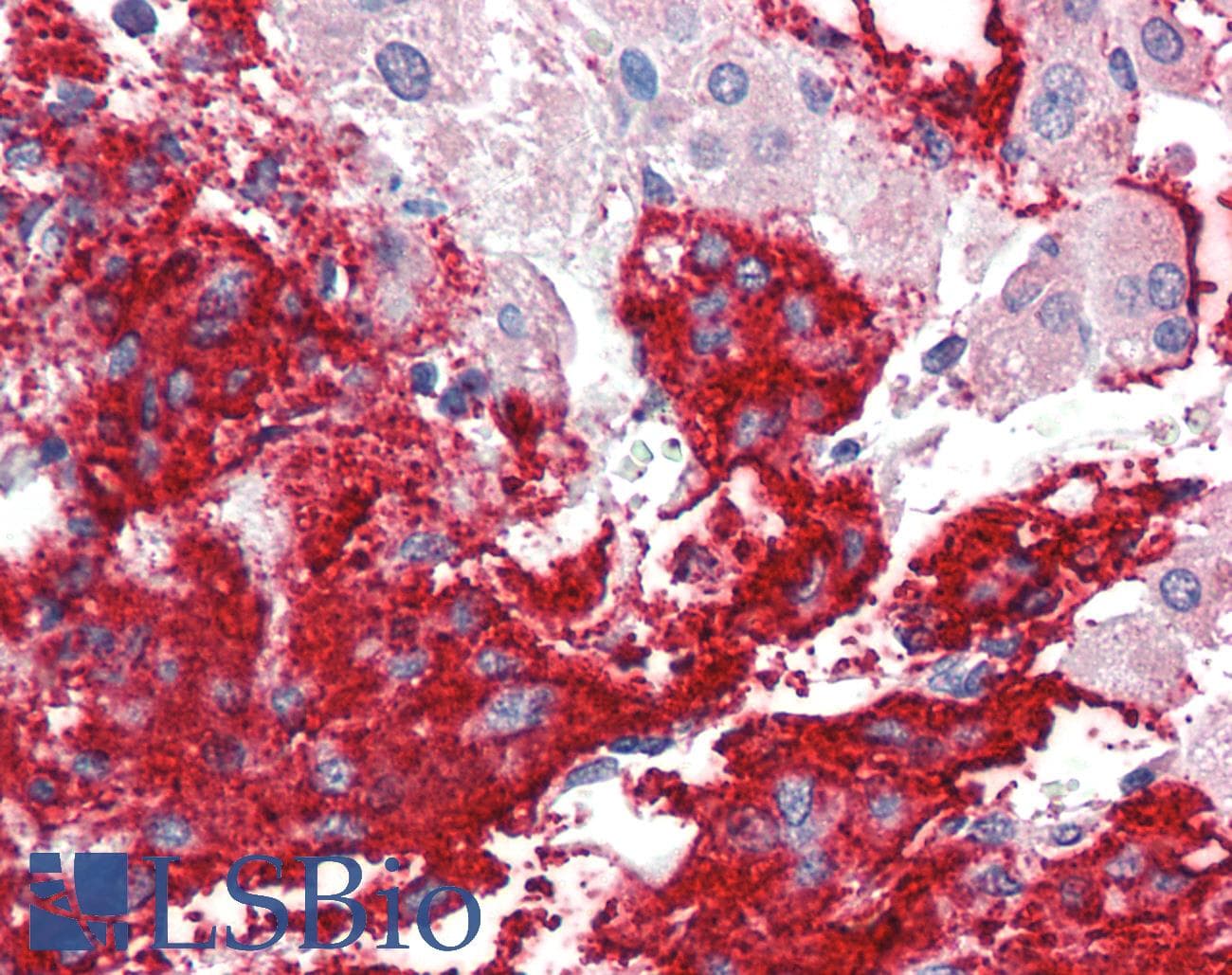IHC-plus™ Polyclonal Goat anti-Human NLGN2 / Neuroligin 2 Antibody (aa165-177, IHC, WB)