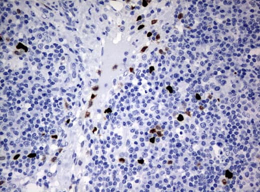 Monoclonal Mouse anti-Human PBX1 Antibody (clone UMAB111, IHC, IF)